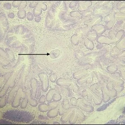 thumbnail for publication: Introduction to Infectious Diseases in Hard Clams